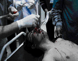 ViolenciaenSiriafotoAFPFoto5