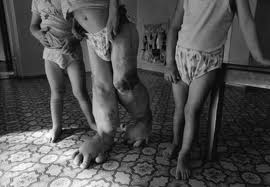 desastresigualesfoto6